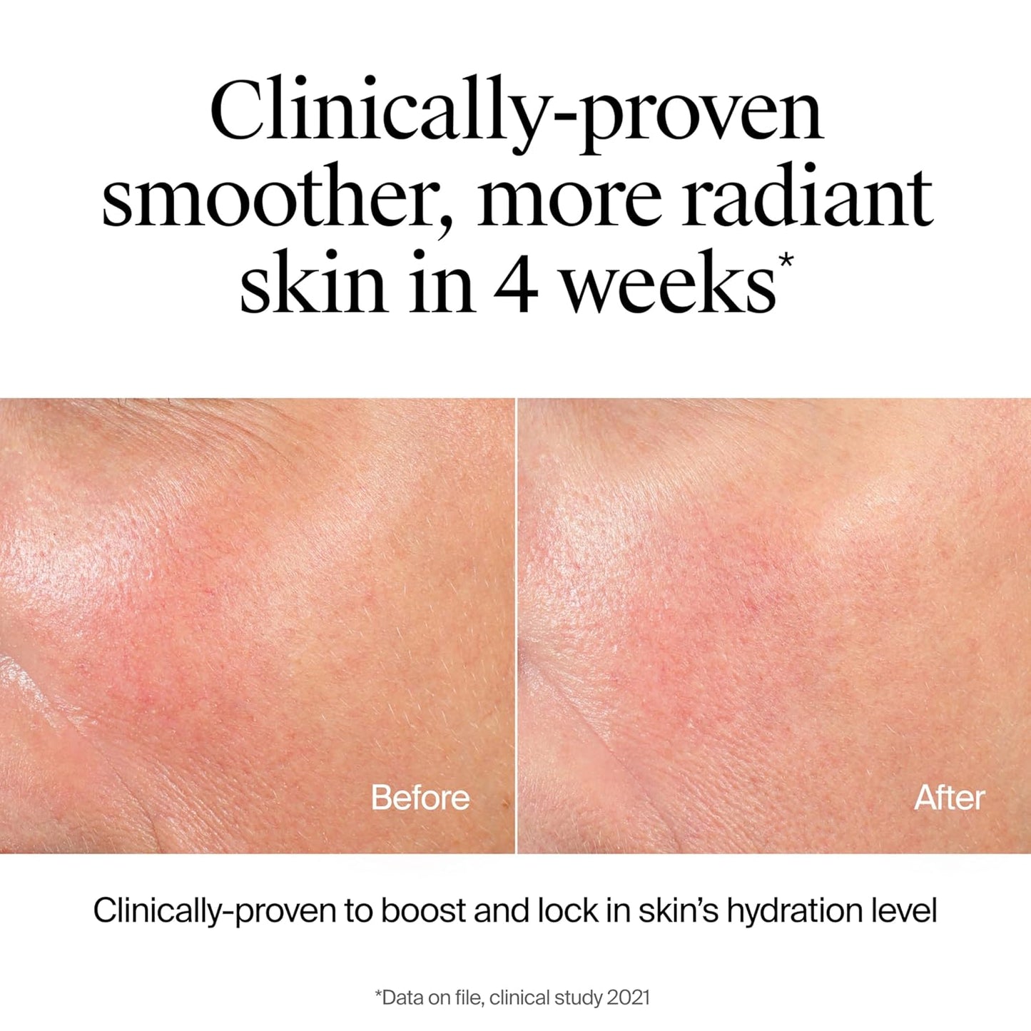 Hydro Boost Facial Cleansing Gel, Hydrating Gentle Face Cleanser and Makeup Remover with Hyaluronic Acid, Hypoallergenic Formula, 7.8 FL OZ