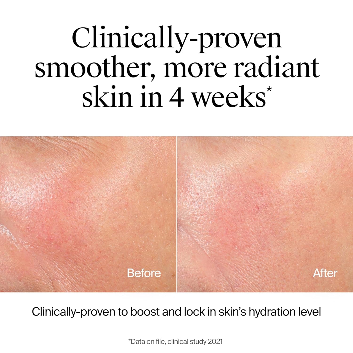 Hydro Boost Facial Cleansing Gel, Hydrating Gentle Face Cleanser and Makeup Remover with Hyaluronic Acid, Hypoallergenic Formula, 7.8 FL OZ