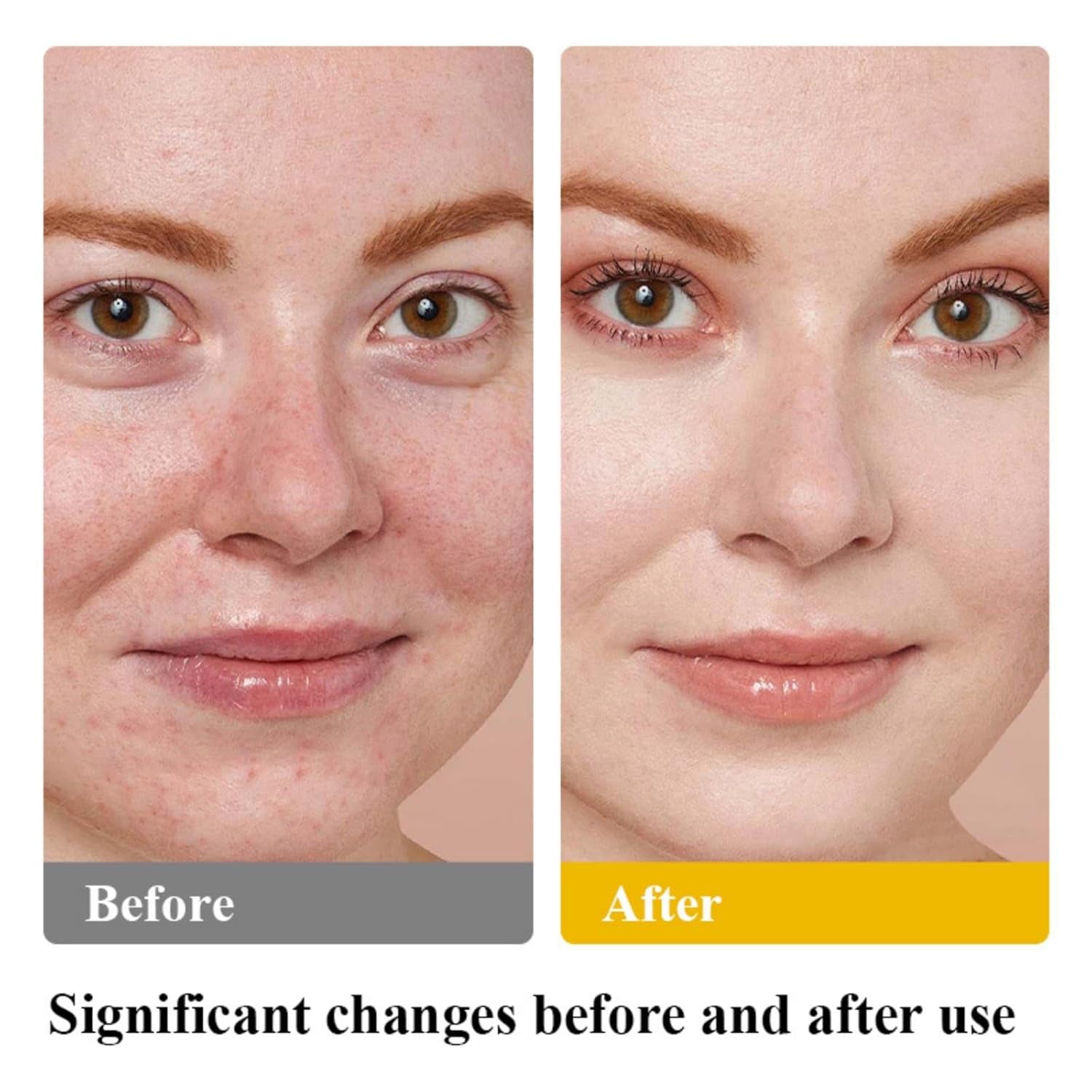 Tallow and Honey Balm, Beef Tallow for Skin, Natural Grass Fed Beef Tallow & Raw Wild Honey Balm, All-Natural Moisturizer for Face & Body, Tallow Balm for Skin Hydration, 2Oz (Honey, 1 Bottle)